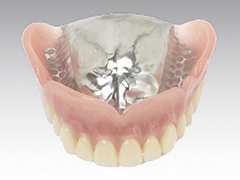 自費診療の入れ歯